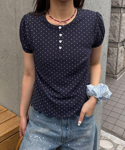 171290776
