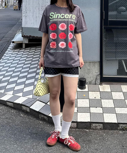 170576332